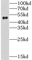 Nicotinic Acetylcholine R alpha 3/CHRNA3 Antibody - BSA Free