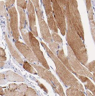 Nicotinic Acetylcholine R alpha 1/CHRNA1 Antibody - BSA Free