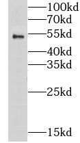 Nicotinic Acetylcholine R alpha 1/CHRNA1 Antibody - BSA Free