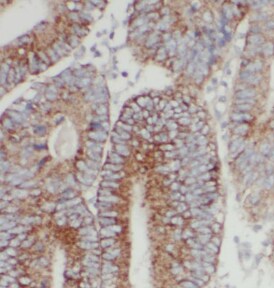 CHSS2 Antibody - N-terminal - BSA Free