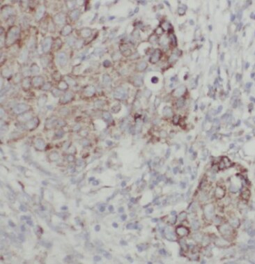 Choline kinase alpha Antibody - BSA Free