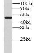 CHMP7 Antibody - BSA Free