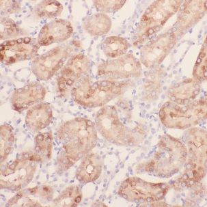 CHMP7 Antibody - BSA Free