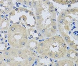 CHMP1B Antibody - BSA Free