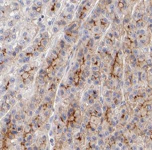 Choline dehydrogenase Antibody - BSA Free