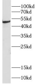 Choline dehydrogenase Antibody - BSA Free
