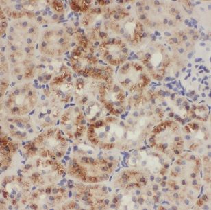CHD9 Antibody - BSA Free
