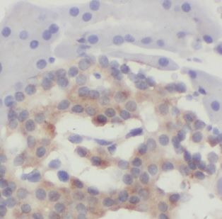 CHCHD7 Antibody - BSA Free