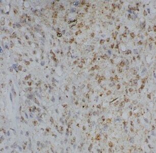 CHCHD6 Antibody - BSA Free