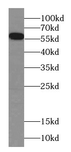 CES7 Antibody - BSA Free