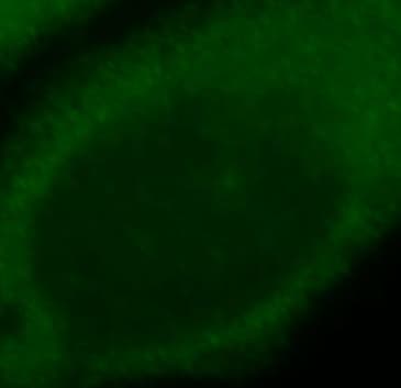CEPT1 Antibody - BSA Free