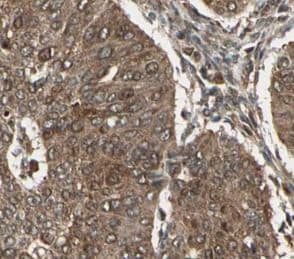 CEPT1 Antibody - BSA Free