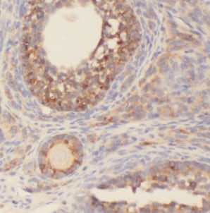 CEP70 Antibody - BSA Free