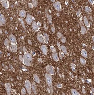 CEP44 Antibody - BSA Free