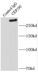 CEP290 Antibody - BSA Free