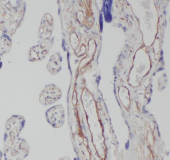 CEP290 Antibody - BSA Free