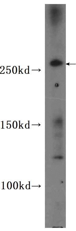 CEP290 Antibody - BSA Free