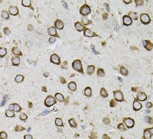 CEP164 Antibody - BSA Free