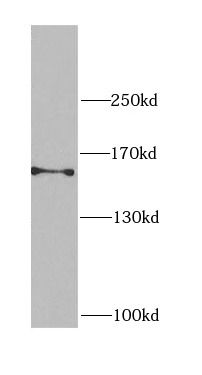 CEP164 Antibody - BSA Free