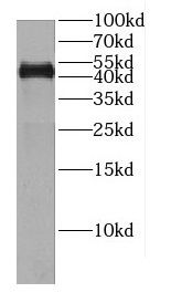 CENPL Antibody - BSA Free