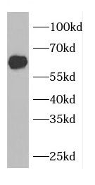 CDKAL1 Antibody - BSA Free