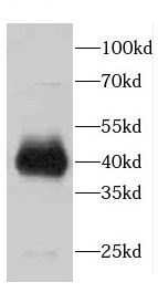 CDCA7 Antibody - BSA Free