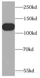 CDCA2 Antibody - BSA Free