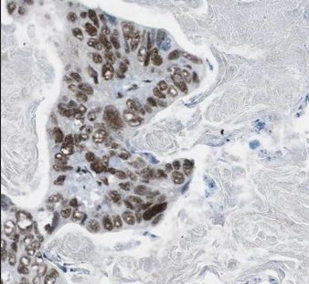 CDCA2 Antibody - BSA Free