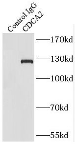 CDCA2 Antibody - BSA Free