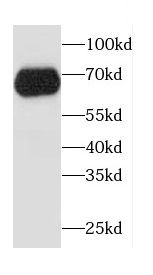 CCDC9 Antibody - BSA Free