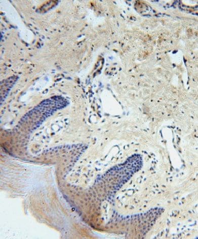 CCDC72 Antibody - BSA Free
