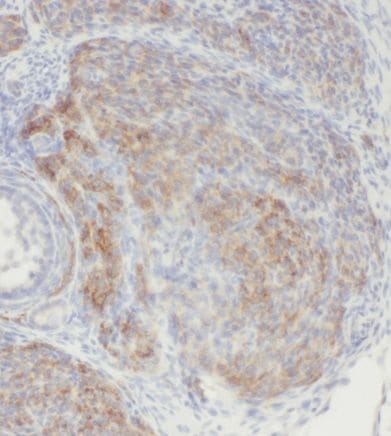 CCDC51 Antibody - BSA Free