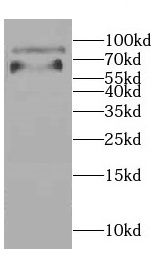 CCDC41 Antibody - BSA Free