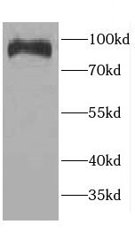 CCDC40 Antibody - BSA Free