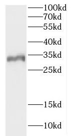 CCDC28B Antibody - BSA Free