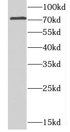 CCDC22 Antibody - BSA Free