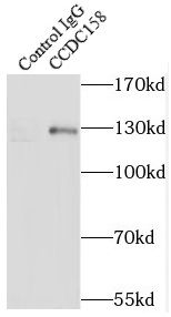 CCDC158 Antibody - BSA Free