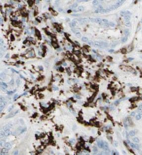 CCDC153 Antibody - BSA Free