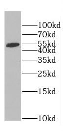 CCDC105 Antibody - BSA Free