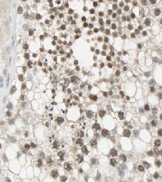 CCDC104 Antibody - BSA Free