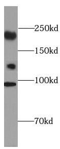 CC2D2A Antibody - BSA Free