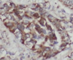 CC2D2A Antibody - BSA Free