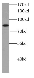 ATPGD1 Antibody - BSA Free