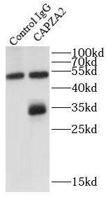 CAPZA2 Antibody - BSA Free