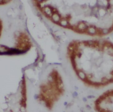 CAMSAP1L1 Antibody - BSA Free