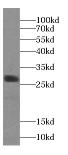 Calpain S2 Antibody - BSA Free