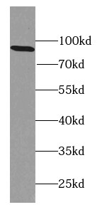 Calpain 7 Antibody - BSA Free