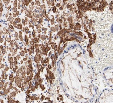 Calpain 6 Antibody - BSA Free
