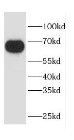 Calpain 6 Antibody - BSA Free