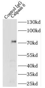 Calpain 6 Antibody - BSA Free
